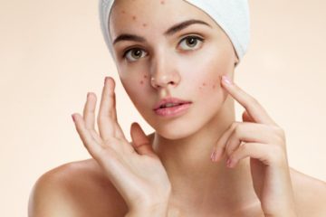 acne pustule treatment