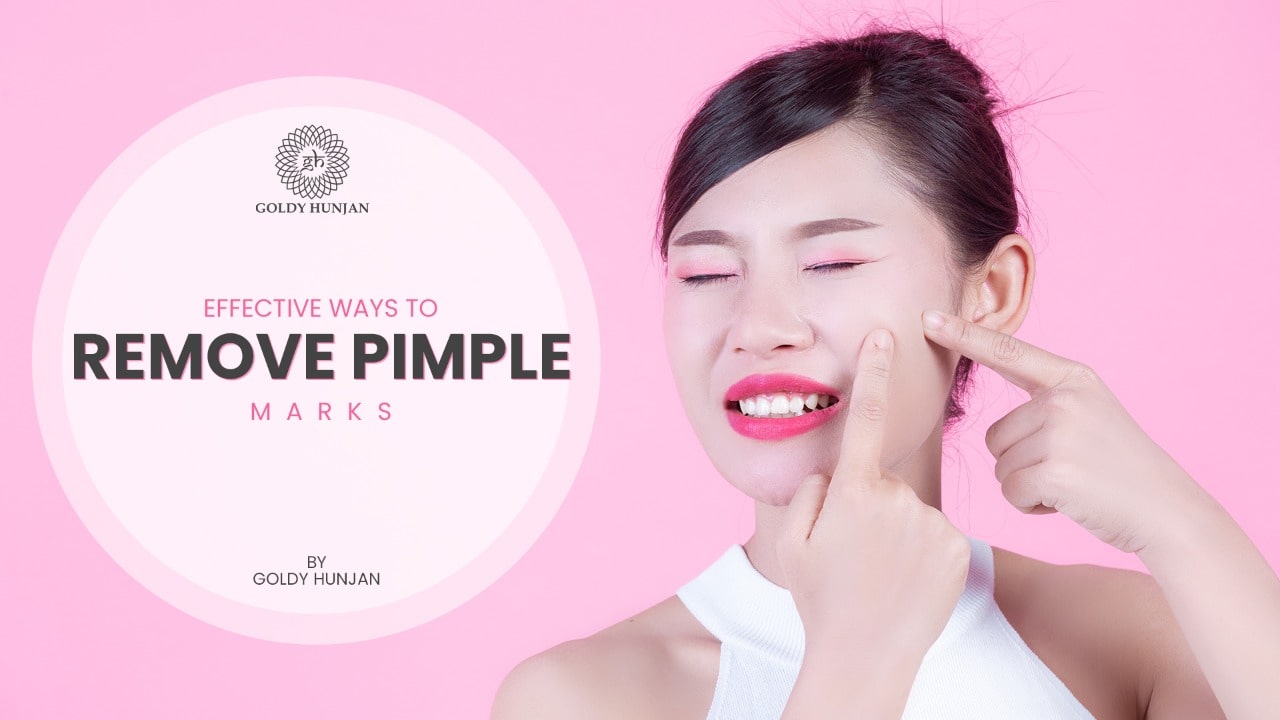 Remove pimple marks