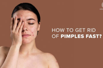 how to get rid of pimples