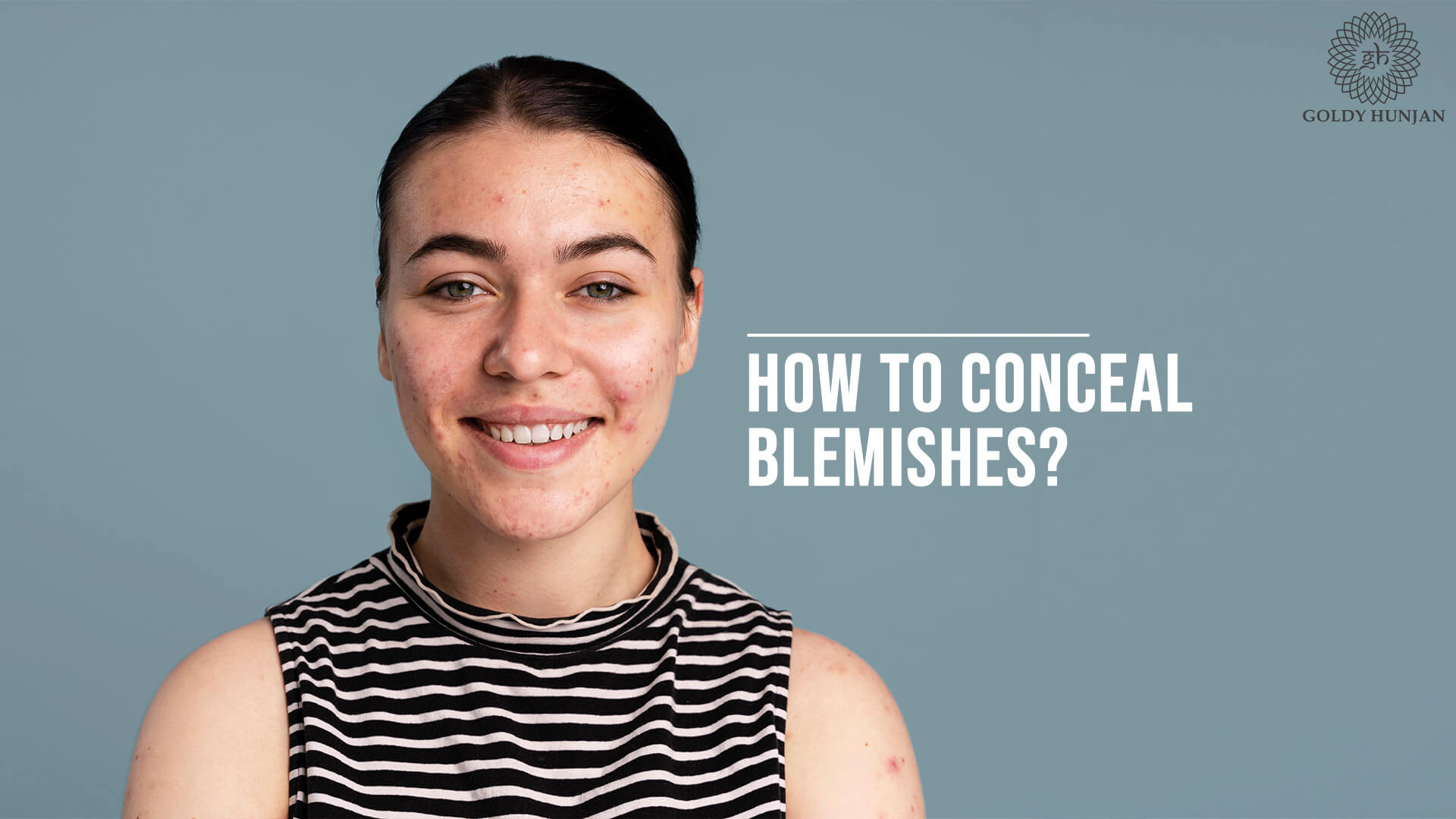 How to conceal blemishes