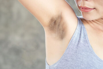 How to get rid of dark armpits naturally?